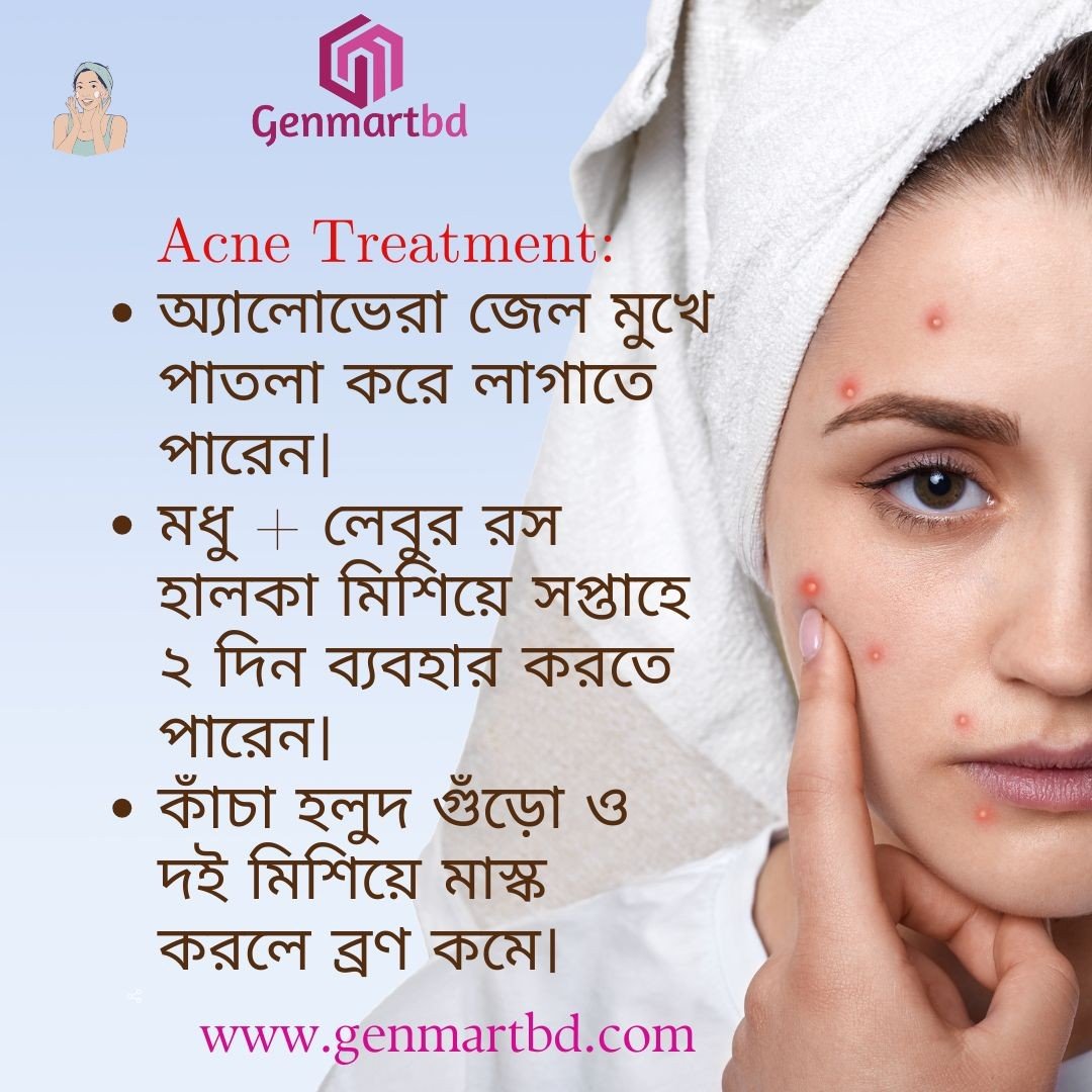 মহিলাদের জন্য ব্রণ চিকিৎসা ও যত্নের করণীয় —